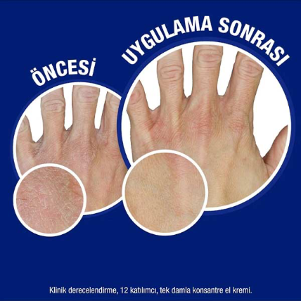 کرم دست تیوپی نیتروژینا اورجینال مناسب پوست های خشک و ترک خورده ۵۰میل
