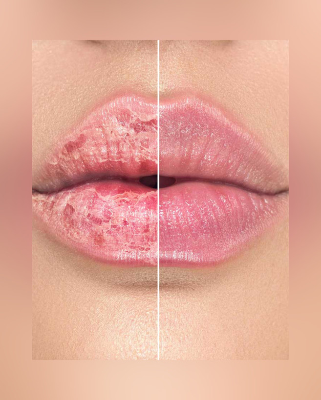 تینت بالم لب جامد گلدن رز SPF 15